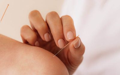 Acupuncture Fun Facts