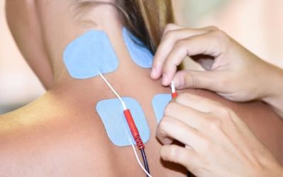 E-Stim