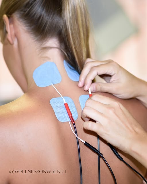 E-Stim