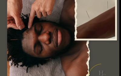 Acupuncture for Headaches and Migraines