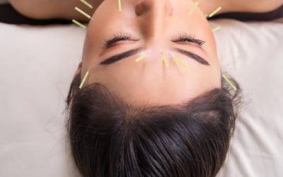 Acupuncture Packages