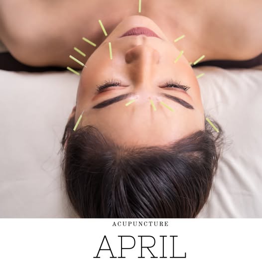 Acupuncture at Hulsebus Chiropractic in St. Peter, MN